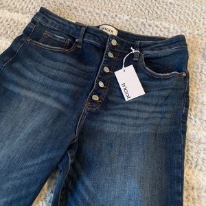 Tricot Button Fly Mid-Rise Ankle Skinny Jeans